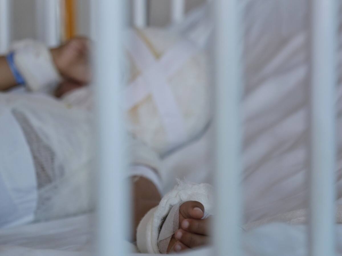 Tres quemados durante las celebraciones de navidad en Ibagué