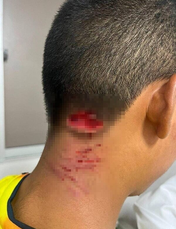 Colprensa- Cortesía