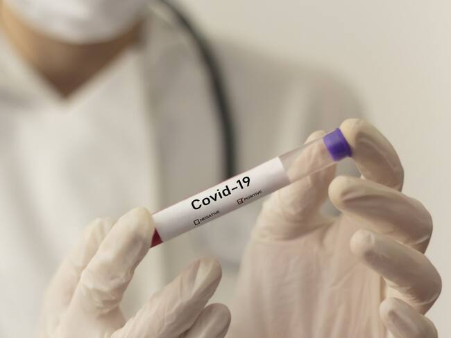 Bogotá cuenta con 200 mil nuevas pruebas para diagnóstico de COVID-19