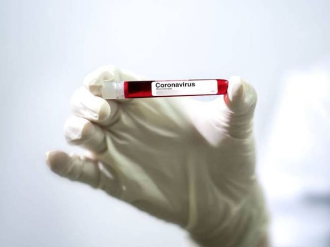 Un nuevo caso de coronavirus se confirmó en Pereira