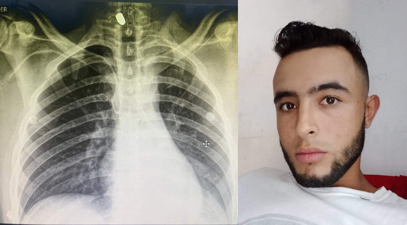 Imágenes tomadas de Facebook