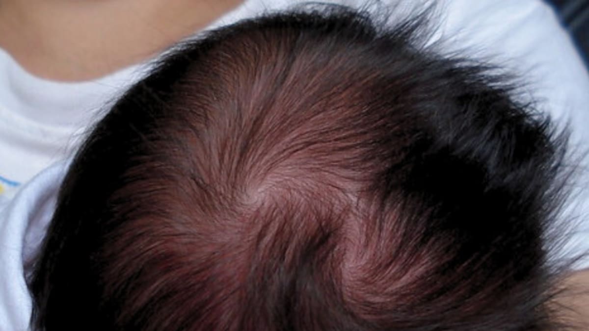 Los significados espirituales de tener 2 remolinos en la cabeza: ¿definen rasgos de la personalidad?