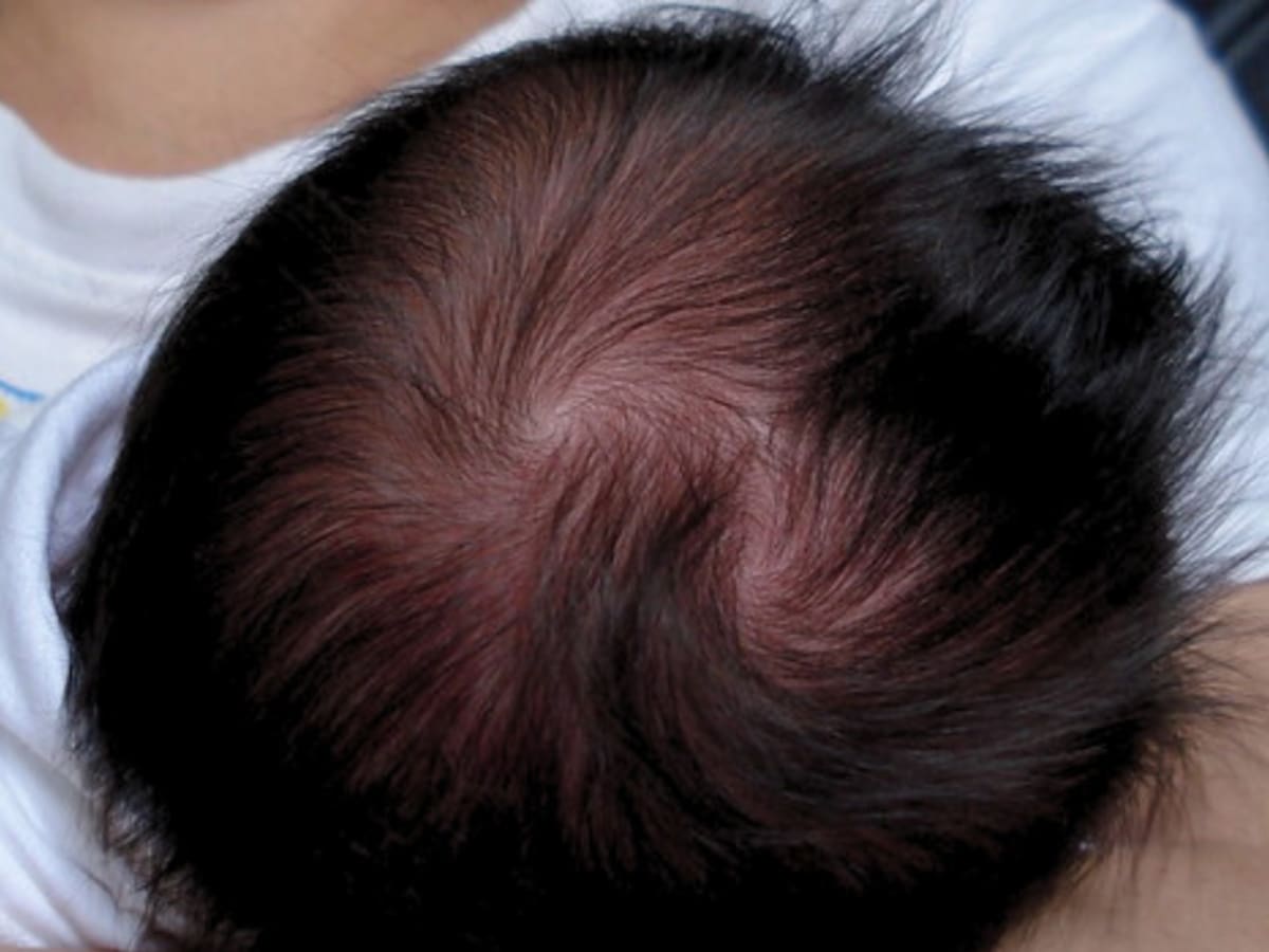 Los significados espirituales de tener 2 remolinos en la cabeza: ¿definen rasgos de la personalidad?