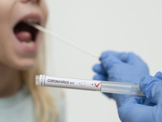 Imagen de referencia