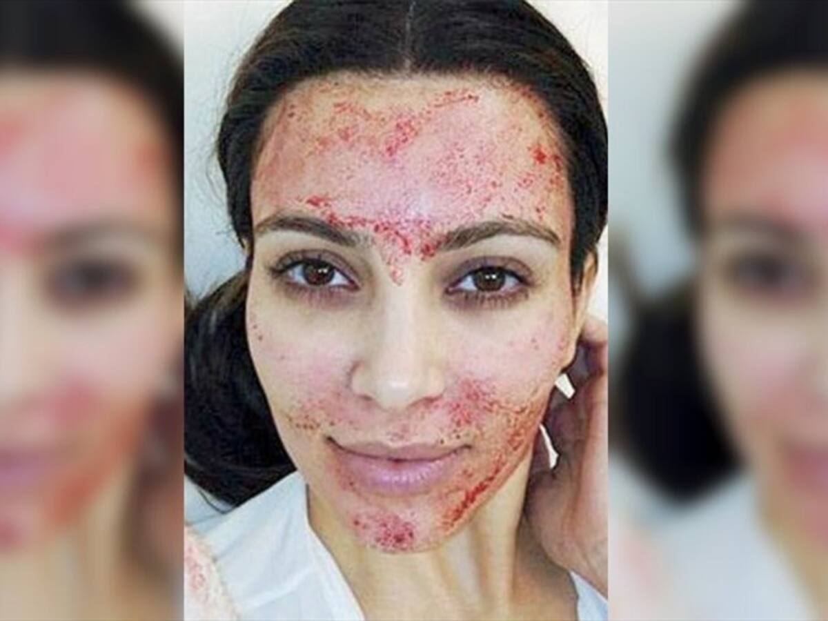 ¿Qué nivel de dolor soportaría por rejuvenecer la piel?