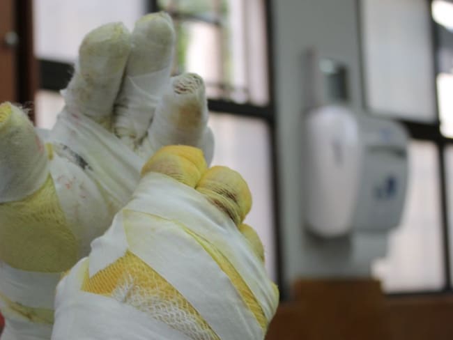 Cuatro quemados, dos menores de edad, en noche de las velitas en Antioquia