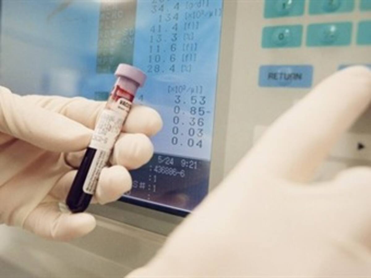 Nueva fórmula aumenta la supervivencia de enfermos de cáncer de páncreas