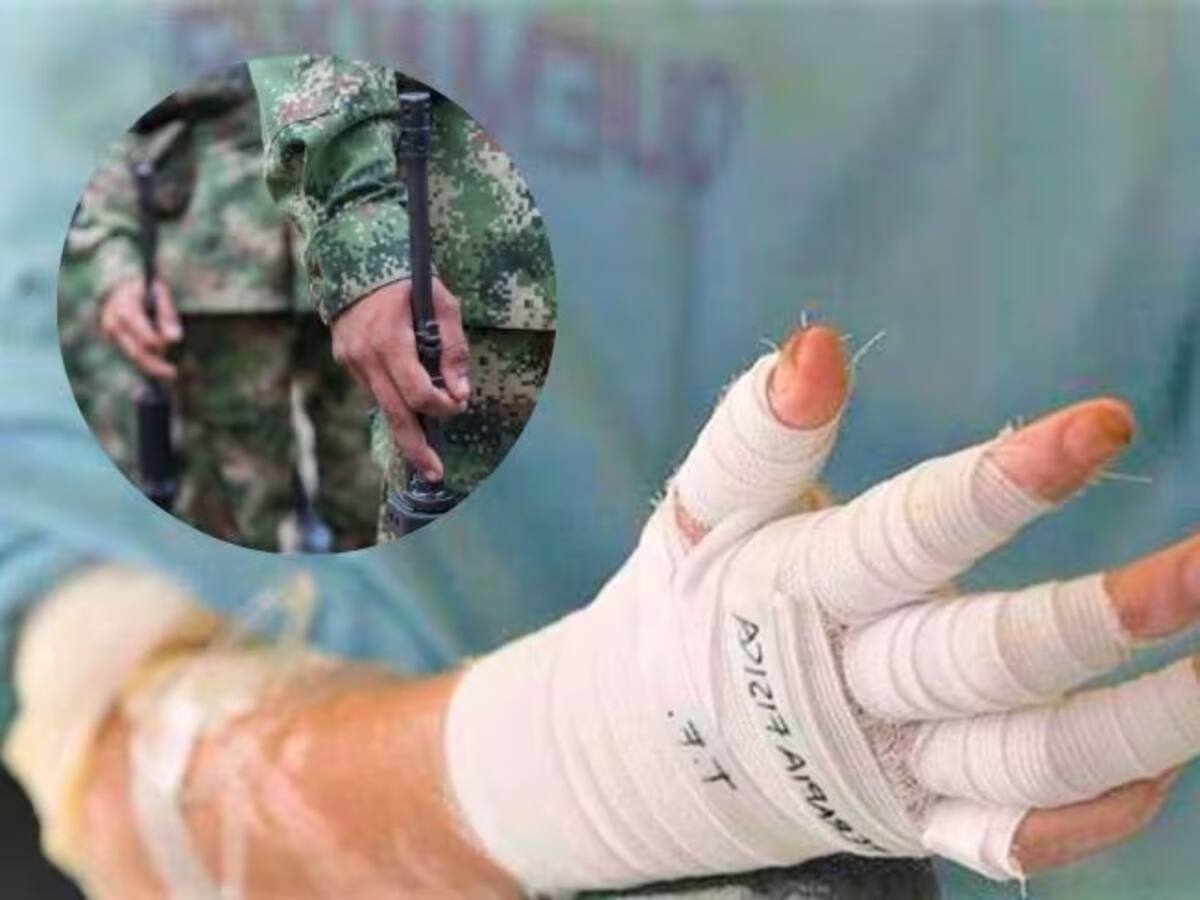 “Si los hombres que nos atacan no están armados, no podemos responder”: soldado quemado vivo