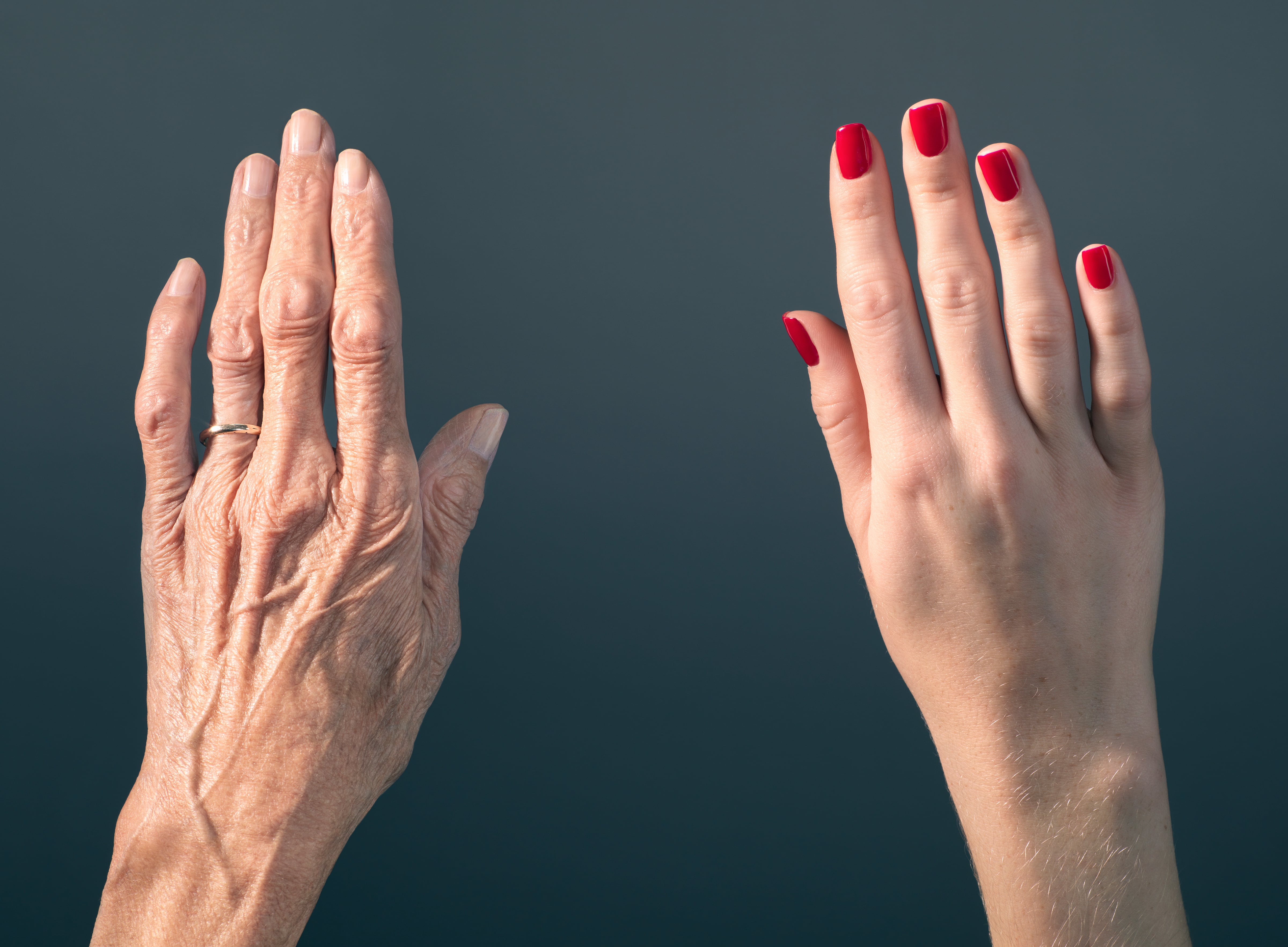 Imagen de referencia vía Getty Imaages