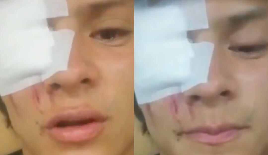 Impactante video muestra cómo tanqueta del ESMAD atropelló a Juan Diego