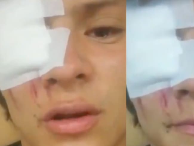 Impactante video muestra cómo tanqueta del ESMAD atropelló a Juan Diego