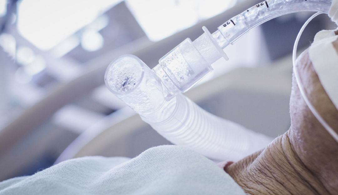 Al comparar la edad de los pacientes que ingresaron a UCI en los tres picos, es mayor el porcentaje de personas menores de 50 años en este tercer pico.