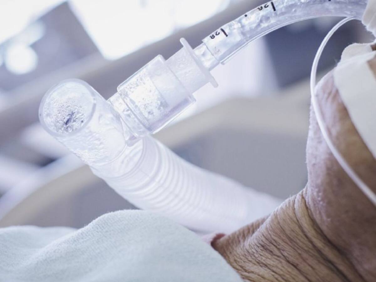 Las muertes por COVID-19 en Cali superan los 30 casos diarios