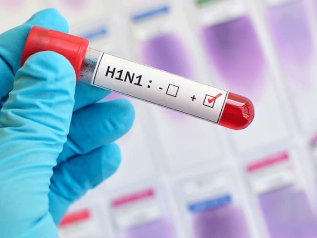 Un agente de tránsito primera víctima de la gripe AH1N1 en el Valle