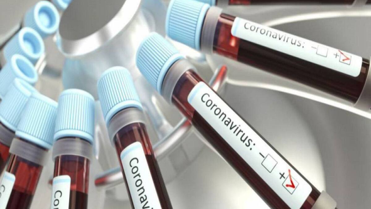 Antioquia ha reducido en un 30% los casos activos de Coronavirus