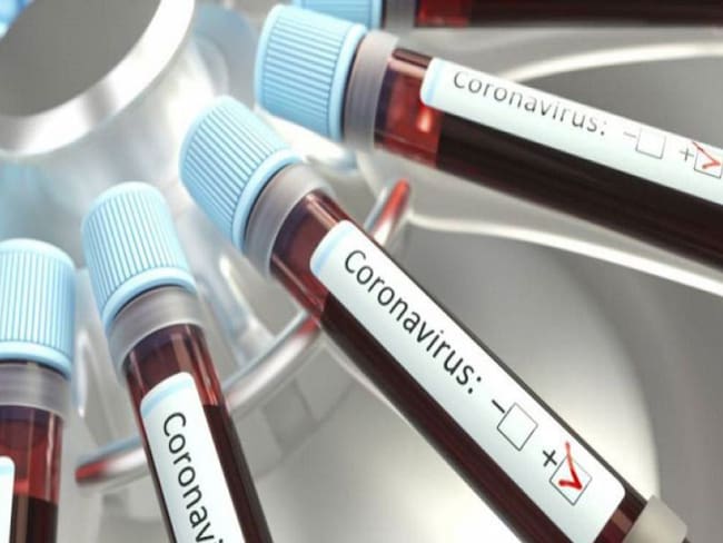 Antioquia ha reducido en un 30% los casos activos de Coronavirus