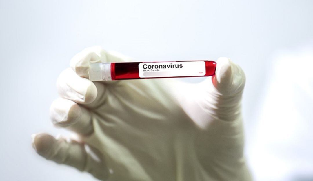 Seis municipios del Valle reportaron que ya completan más de 10 días sin casos positivos. 