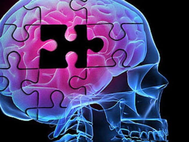 COVID-19 podría producir cambios en el cerebro similares al Alzheimer
