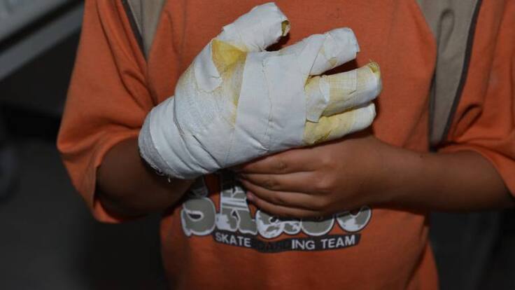 92% se redujo el número de niños quemados con pólvora en el Quindío: Icbf