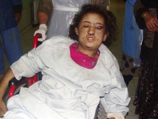 Real Madrid sufre para vencer al Málaga por la Copa del Rey