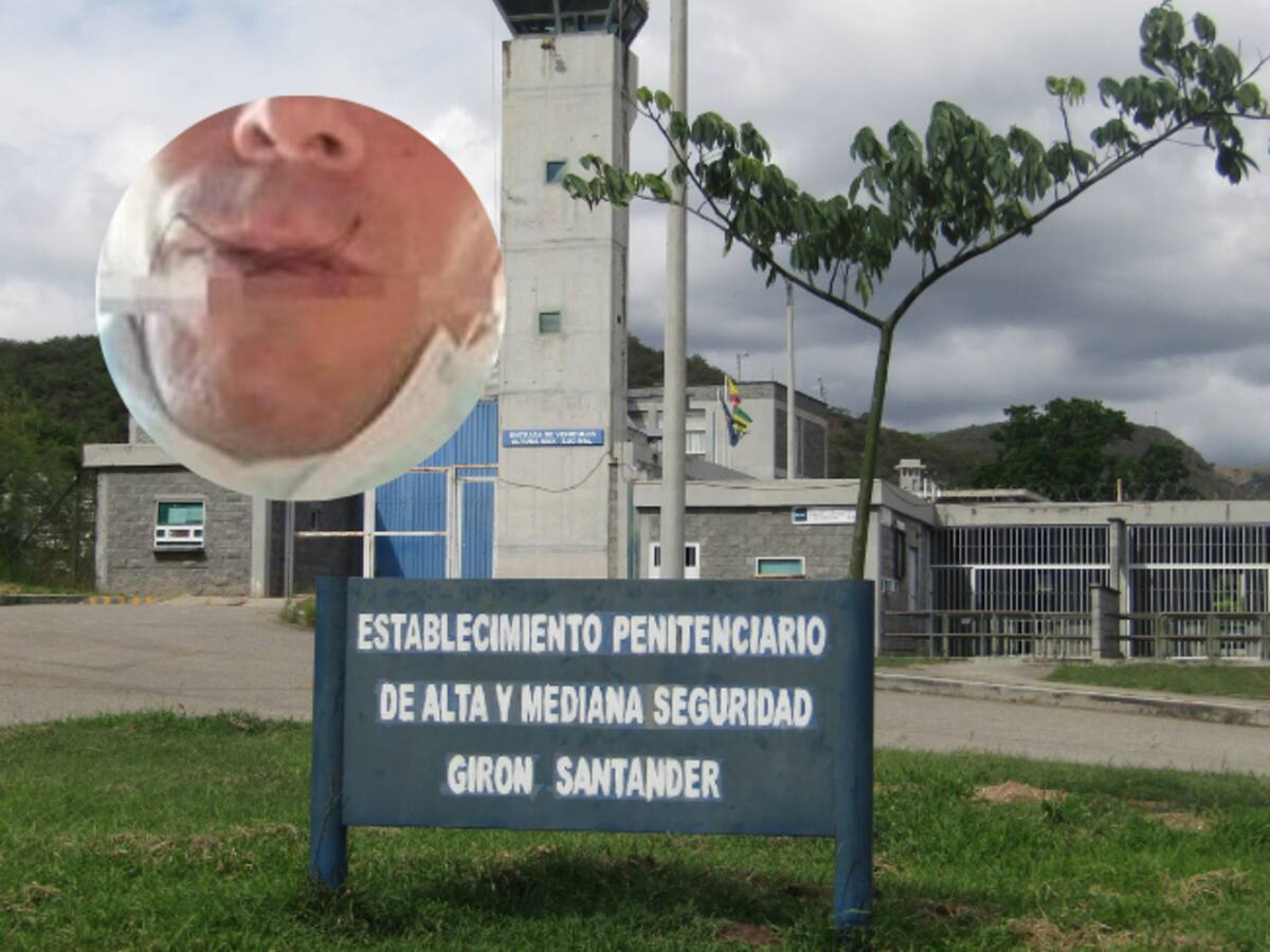 Dos internos en la cárcel de Girón completan una semana con la boca cosida en señal de protesta