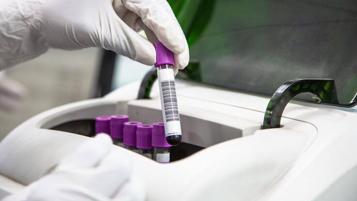 Bogotá comienza pruebas con plasma de pacientes recuperados de coronavirus