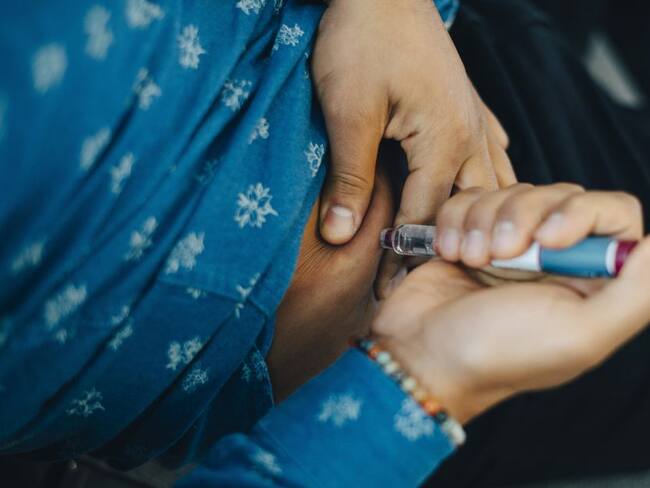 Imagen de referencia