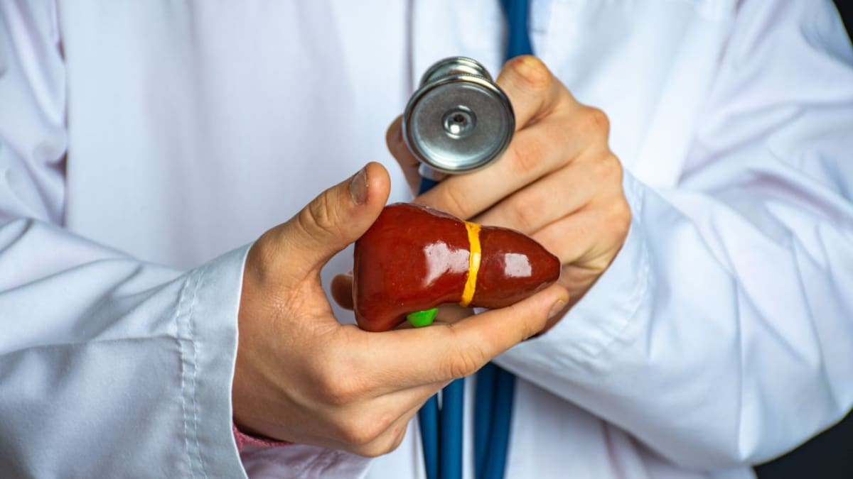 Hepatitis: inflamación del hígado