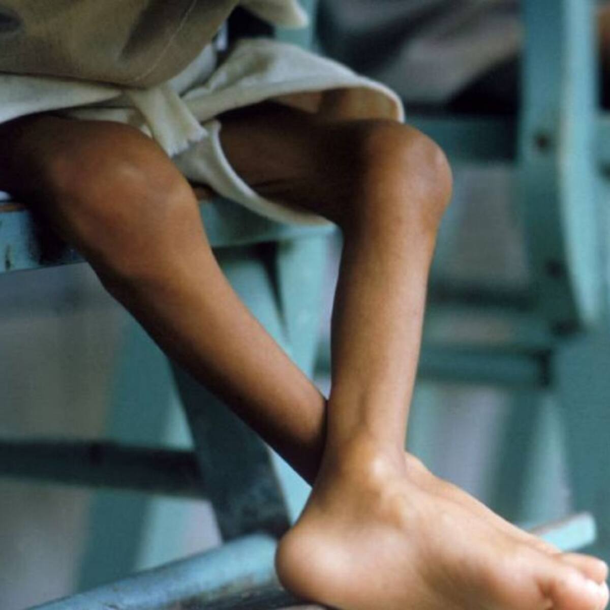 Rescatan a niño wayúu con signos de desnutrición en Uribia