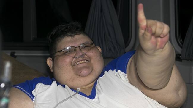 Juan Pedro sonríe a su llegada a un hospital en la ciudad de Guadalajara, México, el martes 15 de noviembre de 2016.. Foto: Associated Press - AP