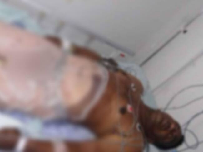 En el Magdalena, mujer le quema con agua caliente el pene a su esposo