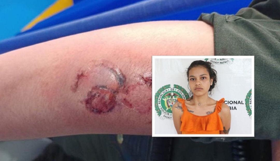 La uniformada fue golpeada y mordida en varias partes de su cuerpo por una ciudadana cuando realizaba un procedimiento de requisa.