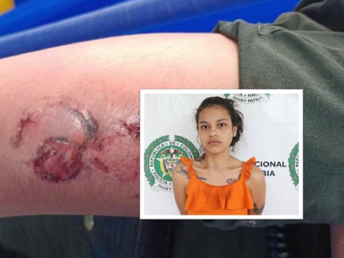 Mordida y golpeada resultó una uniformada de la Policía en Neiva