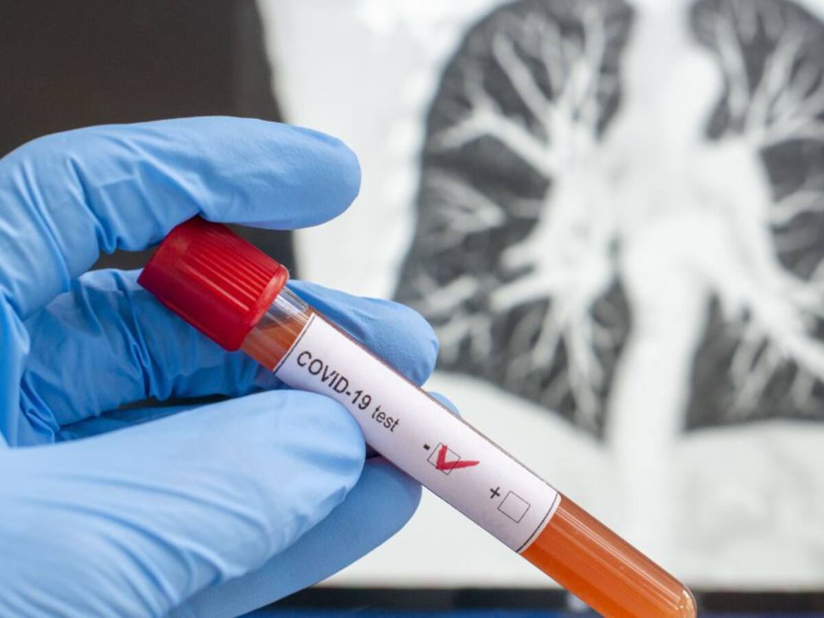 Primeros casos de COVID-19 en San Jorge, subregión de Sucre