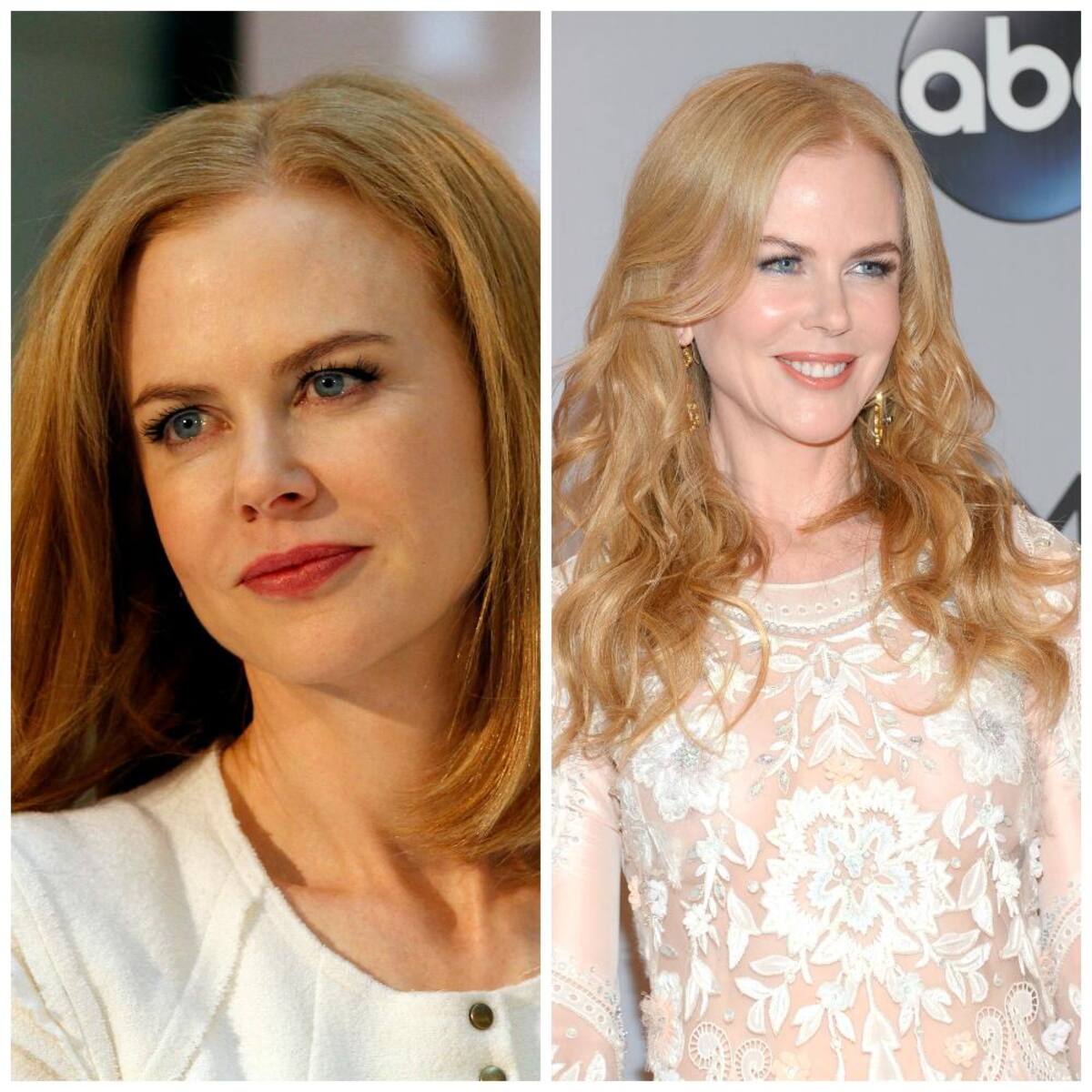 Nicole Kidman.
