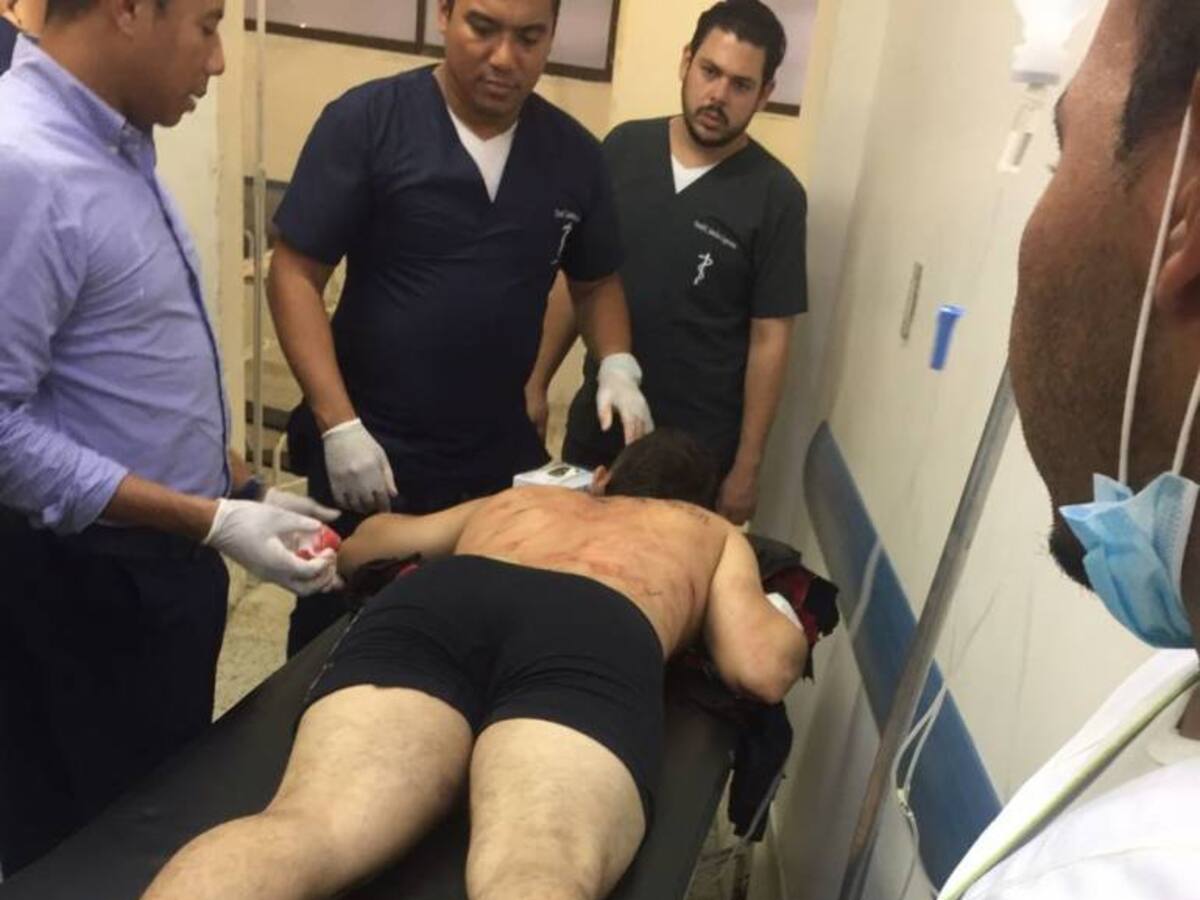 Un muerto y un herido dejan enfrentamientos entre policía y presuntos delincuentes