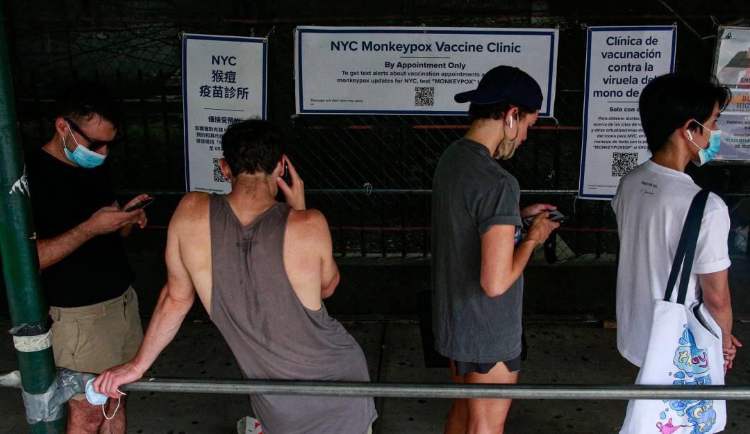 EE.UU. se convierte en el país con mayor contagios en el mundo por viruela del mono.  Foto: Getty
