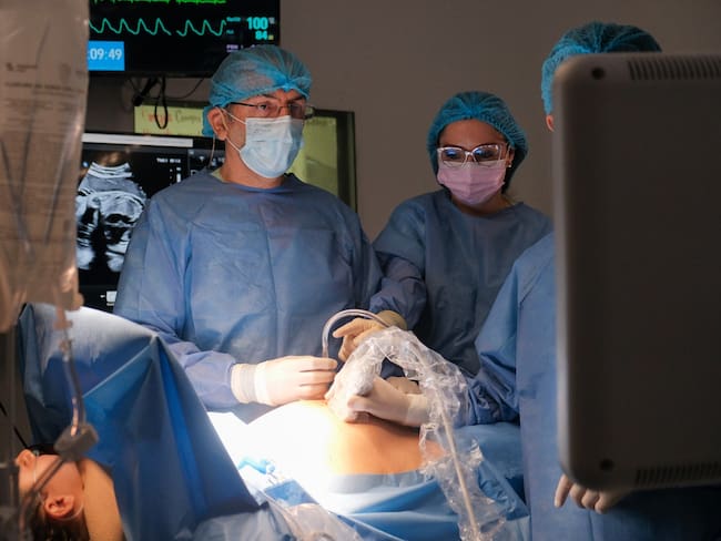 Por primera vez se hizo cirugía cardíaca a feto de 32 semanas