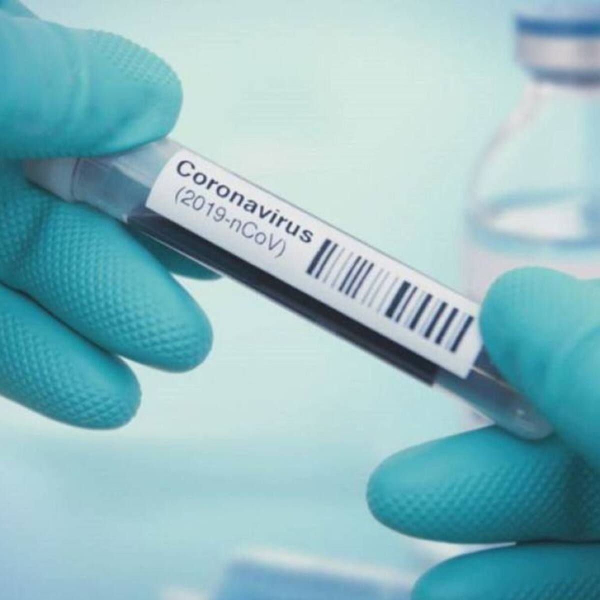 Los casos de COVID-19 en octubre son el 50% de los contagios en pandemia