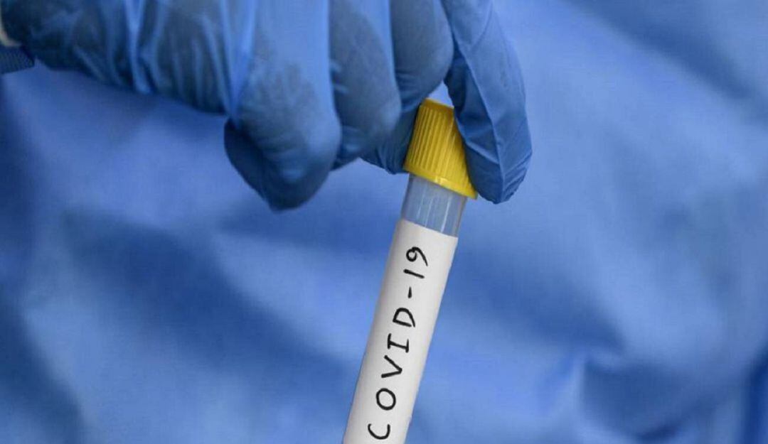 Imagen de referencia