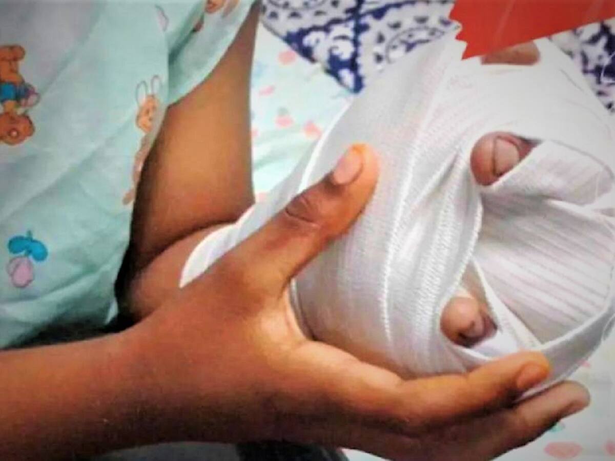 Una mujer quemó a su hija de 4 años para “castigarla”