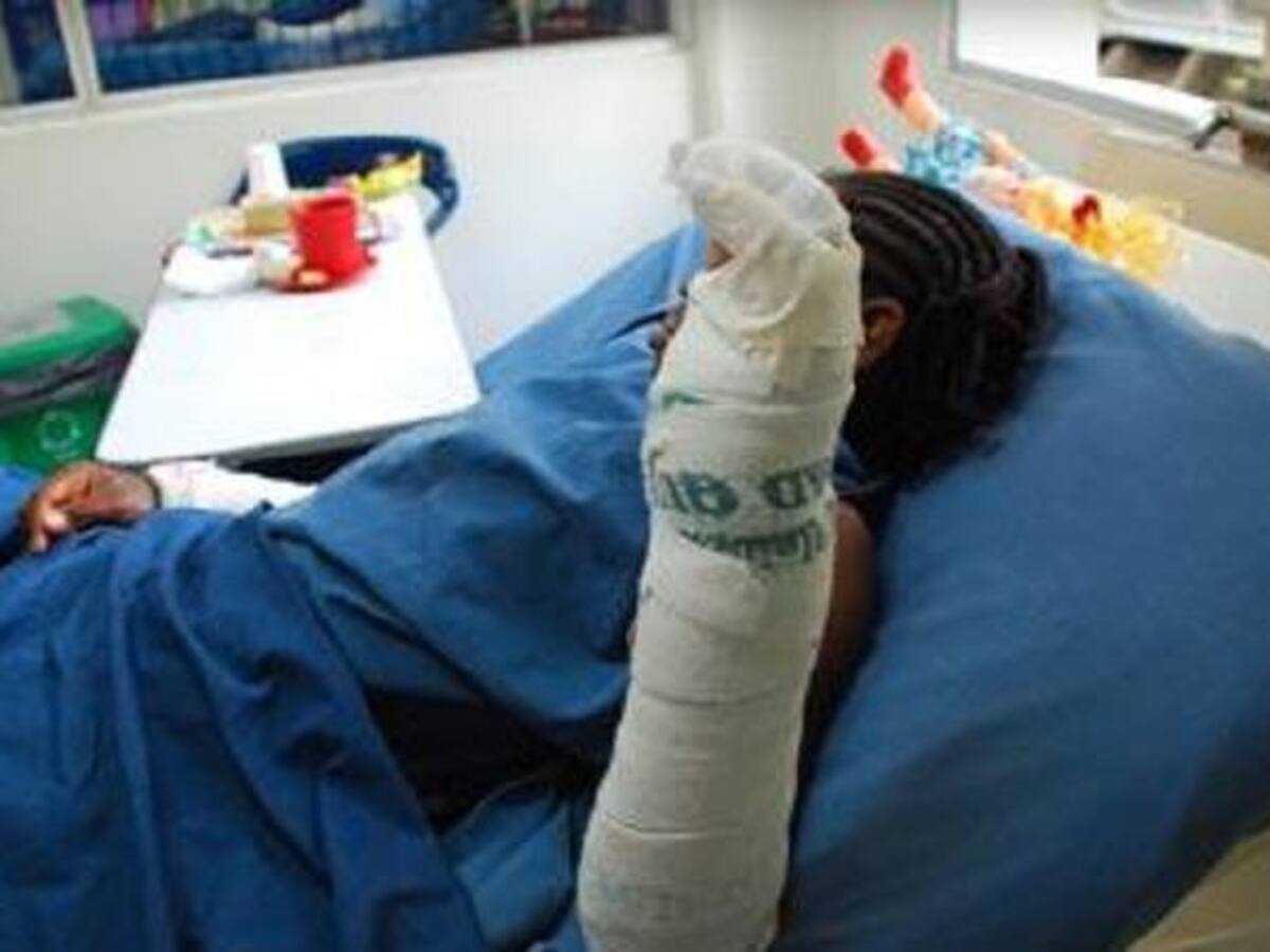 A 167 se elevó la cifra de niños quemados durante diciembre