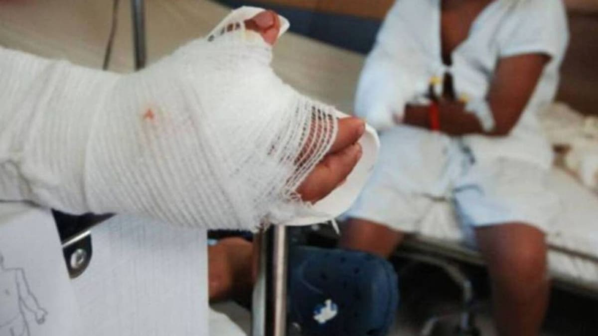 Joven de 19 años es el primer quemado con pólvora en Risaralda