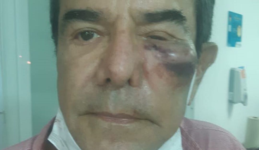 El hecho ocurrió cuando la víctima apoyaba con paleta en mano el buen manejo del tráfico frente al edificio Asturias