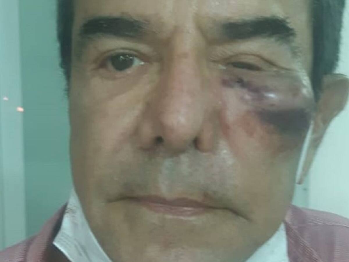 Jairo Berrío fue agredido por taxista que invadió carril en Bocagrande