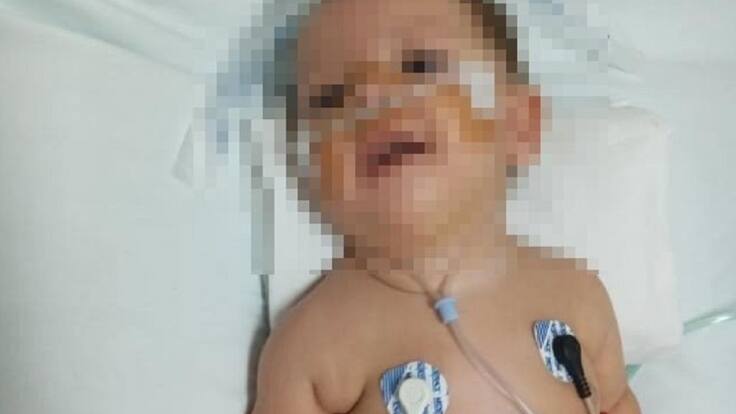 Bebé necesita medicamento de mil millones de pesos para salvar su vida