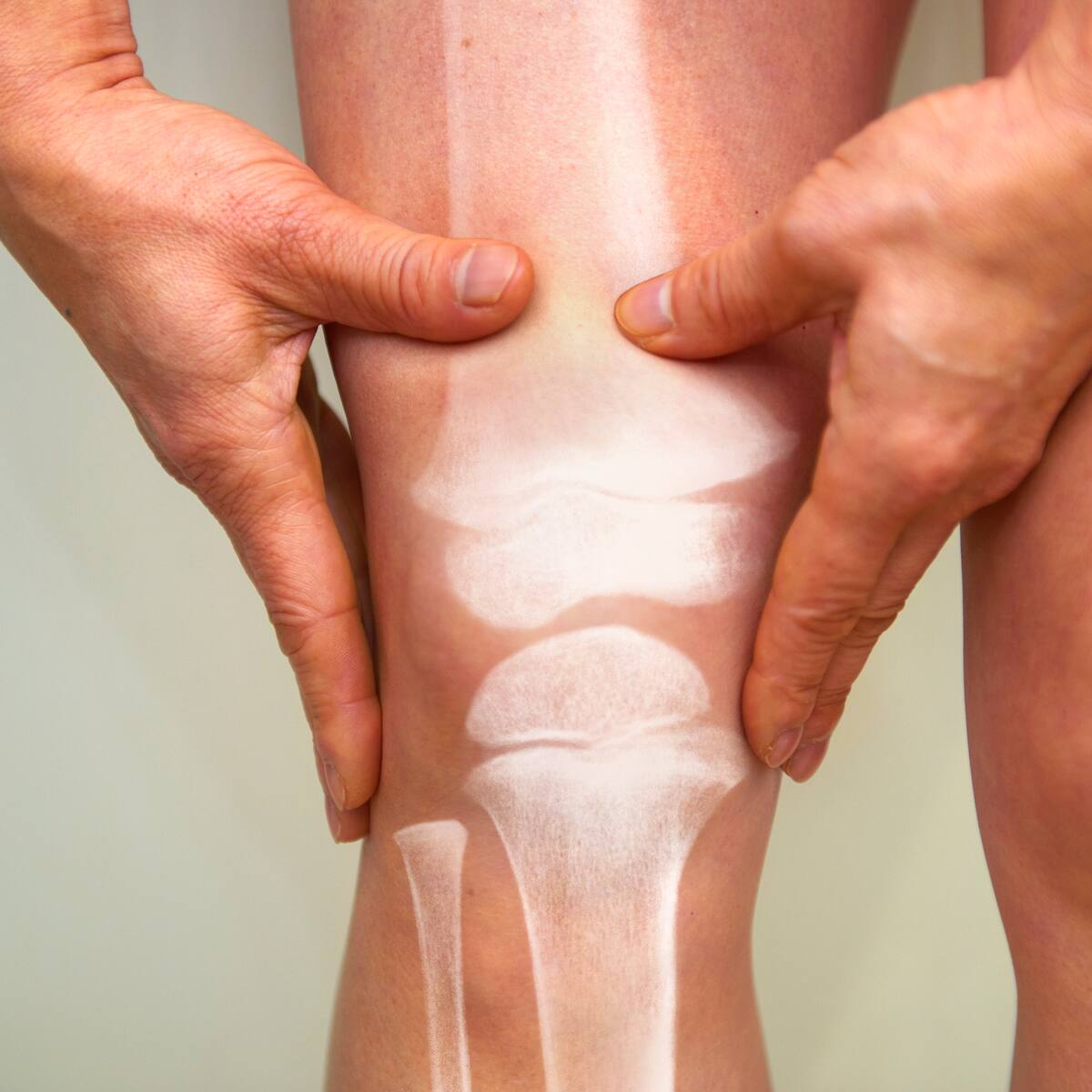 ¿Artritis o artrosis? Diferencias y señales con las que se manifiestan estas enfermedades
