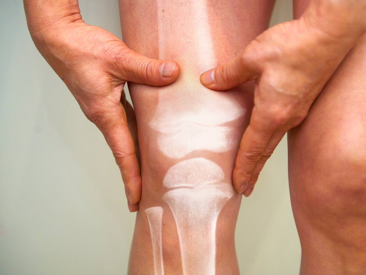 ¿Artritis o artrosis? Diferencias y señales con las que se manifiestan estas enfermedades