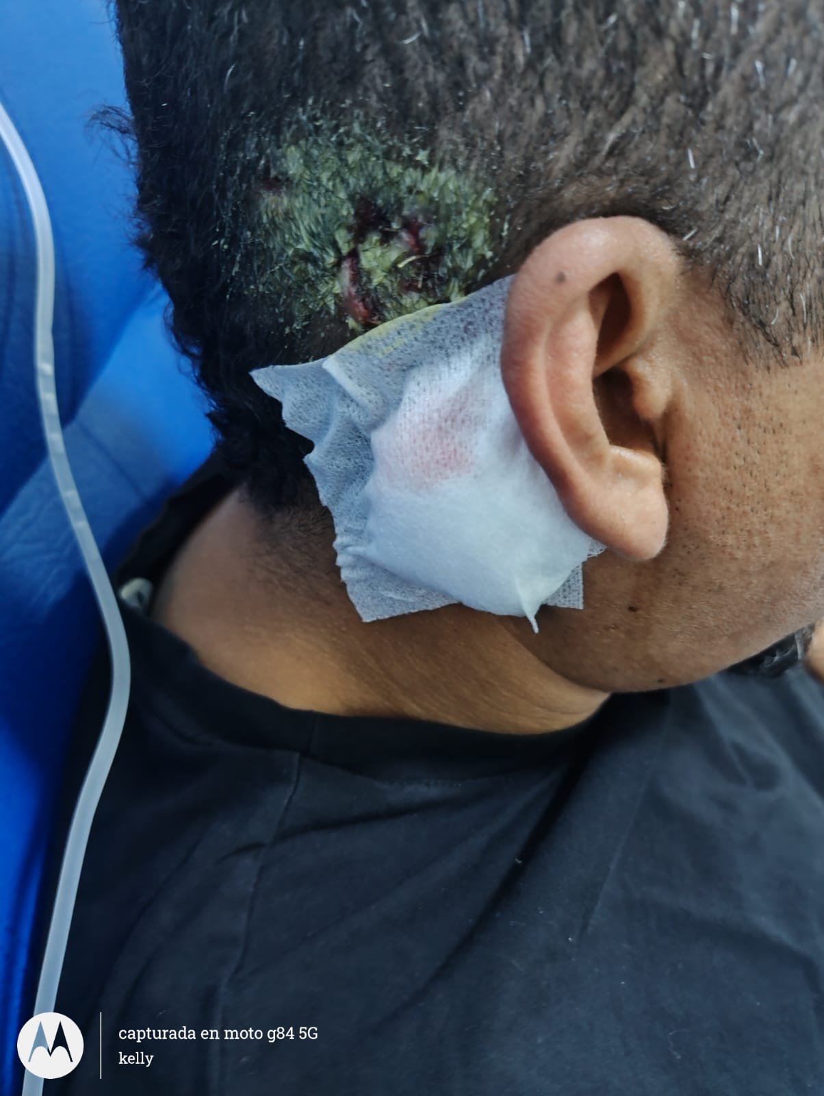 Residente de Parque Heredia fue brutalmente agredido en una parada de Transcaribe