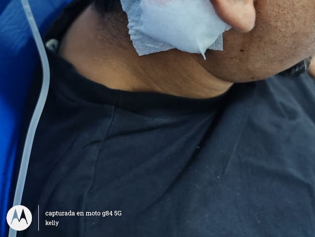 Residente de Parque Heredia fue brutalmente agredido en una parada de Transcaribe